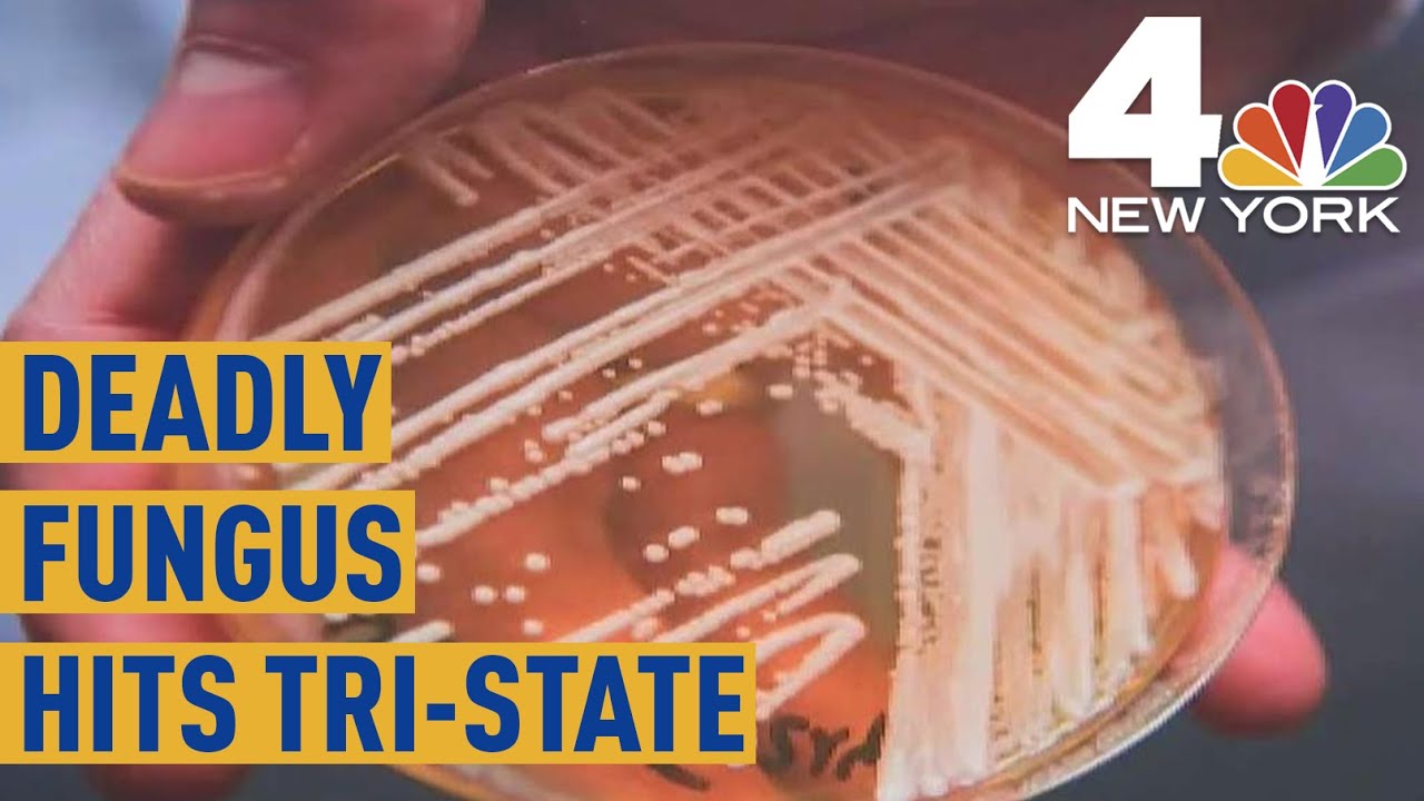 Drug-Resistant Superbug Candida Auris Spreading in New York | NBC New York