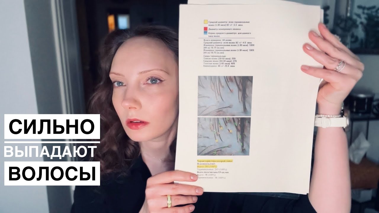 Телогеновое выпадение волос. Андрогенетическая алопеция. Моя история и лечение