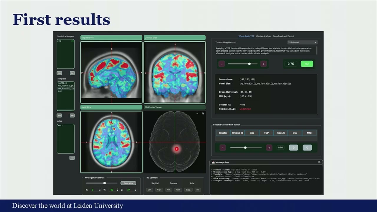 OHBM 2025 | Oral Session | Lucas Peek | ARIbrain: Fast and flexible statistical analysis of fMRI d…