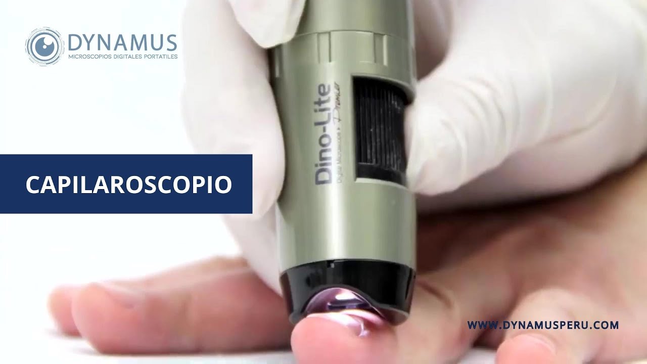 Dino-Lite para Capilaroscopio