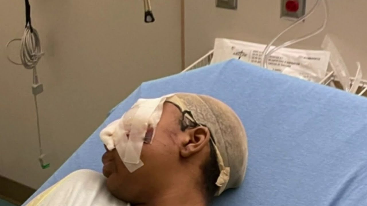 Business shut down after hair spray explosion hospitalized 14-year-old girl on Detroit's west side