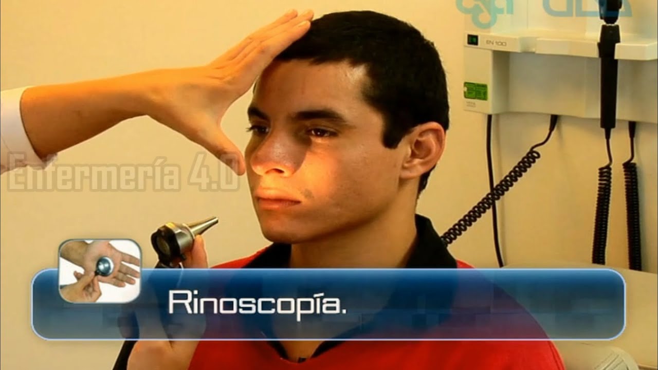 🌟RINOSCOPÍA🌟