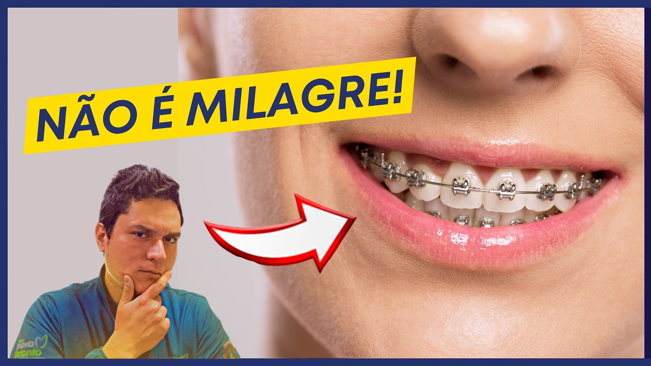5 coisas que o aparelho NÃO faz (e ninguém te conta)