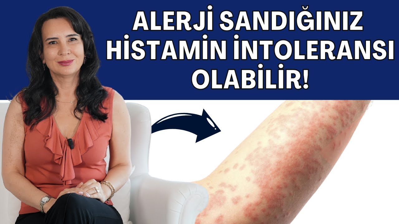 Alerji Sandığınız Histamin İntoleransı Olabilir! I Dr. Nilüfer Yıldırım