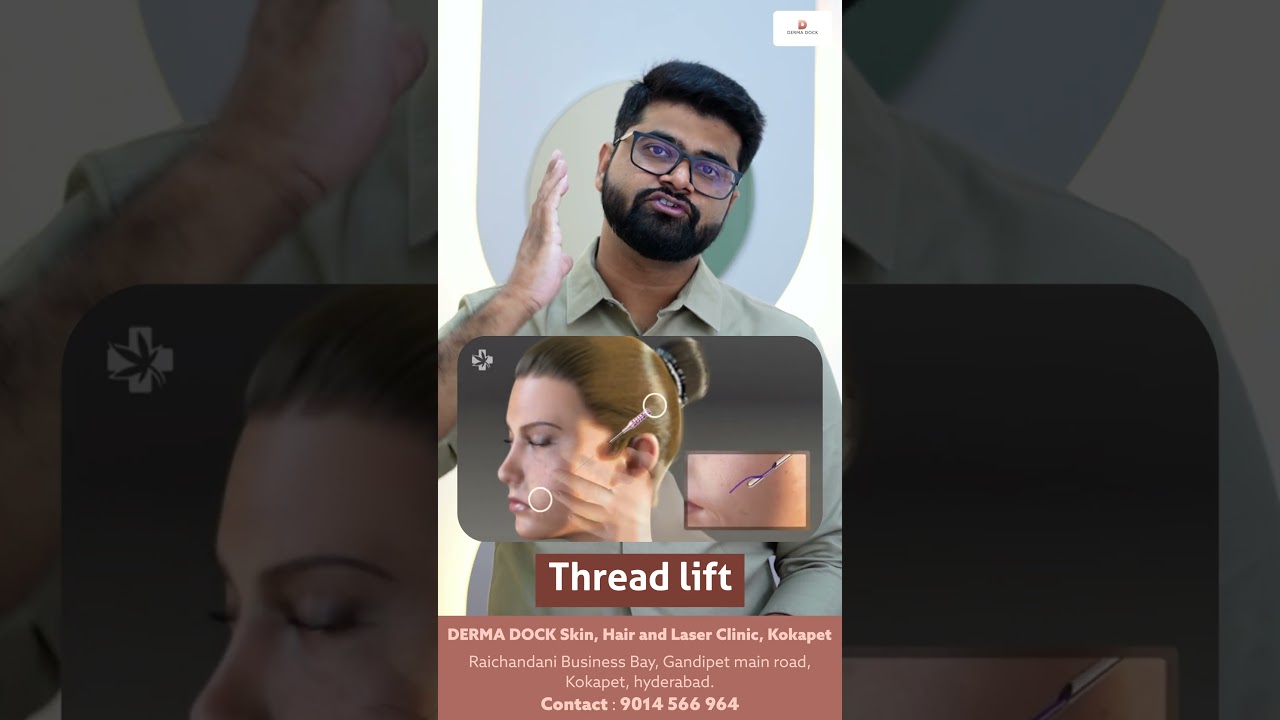How Thread Lift Works | Beauty Transformations | Thread Lift Before and After 