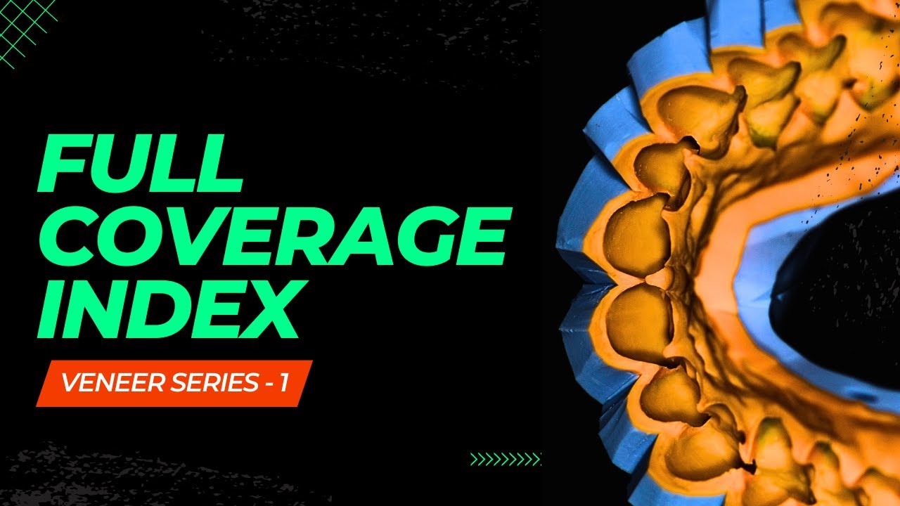Full Coverage Index for Indirect Mock up for Smile Designing