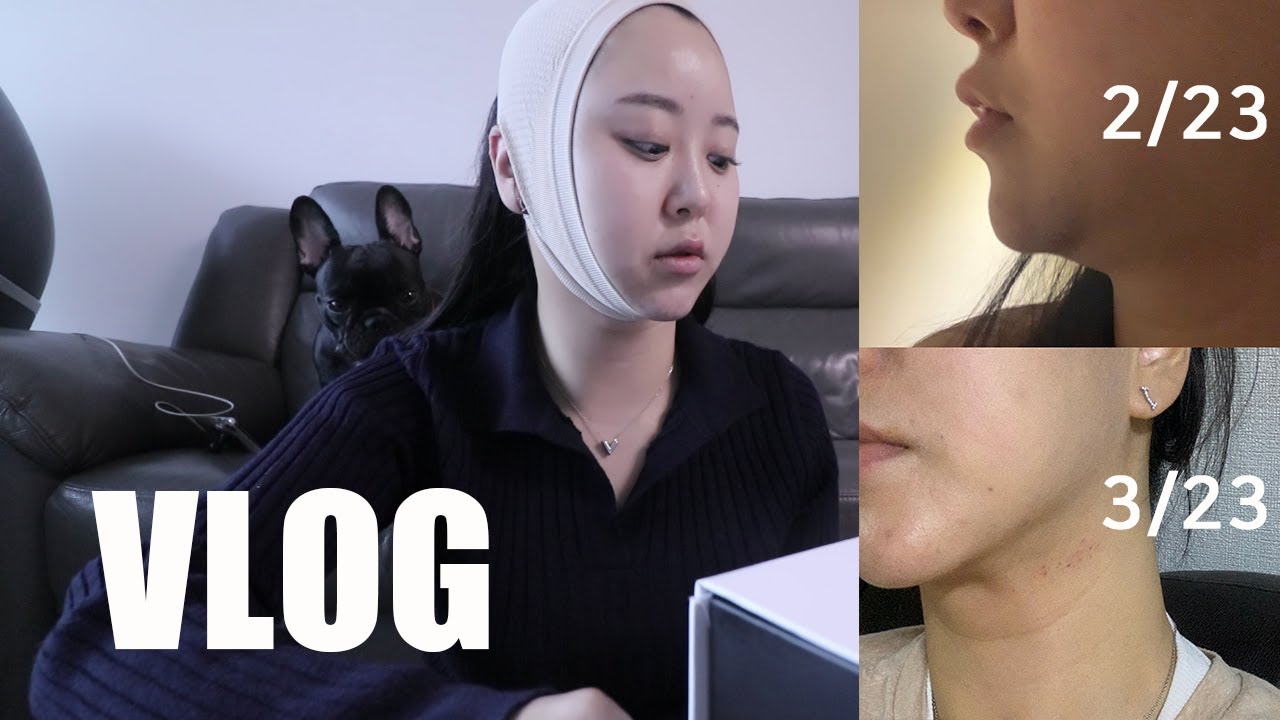 VLOGㅣ드디어 이중턱 지방흡입 브이로그 (내돈내산, 비포애프터, 한달결과, 다이어트vlog, 일반식 다이어트 식단, 여드름관리, 가방하울)