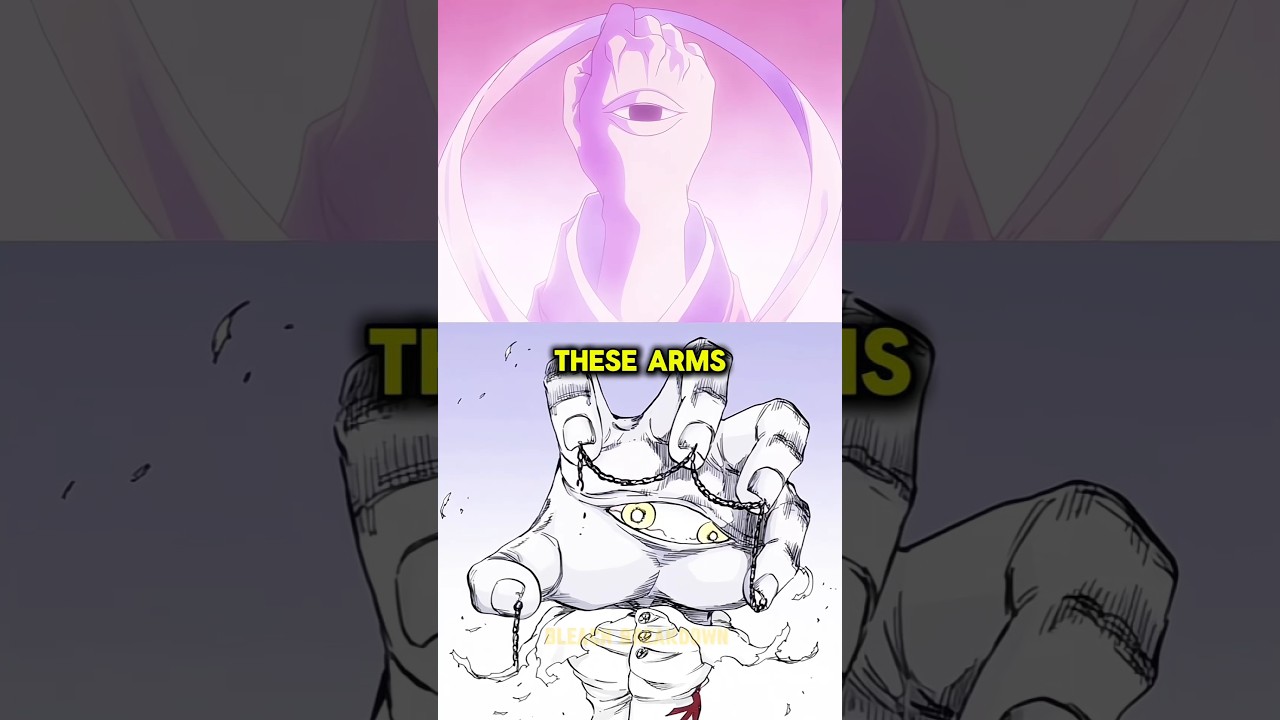 what happened to soul king body parts.