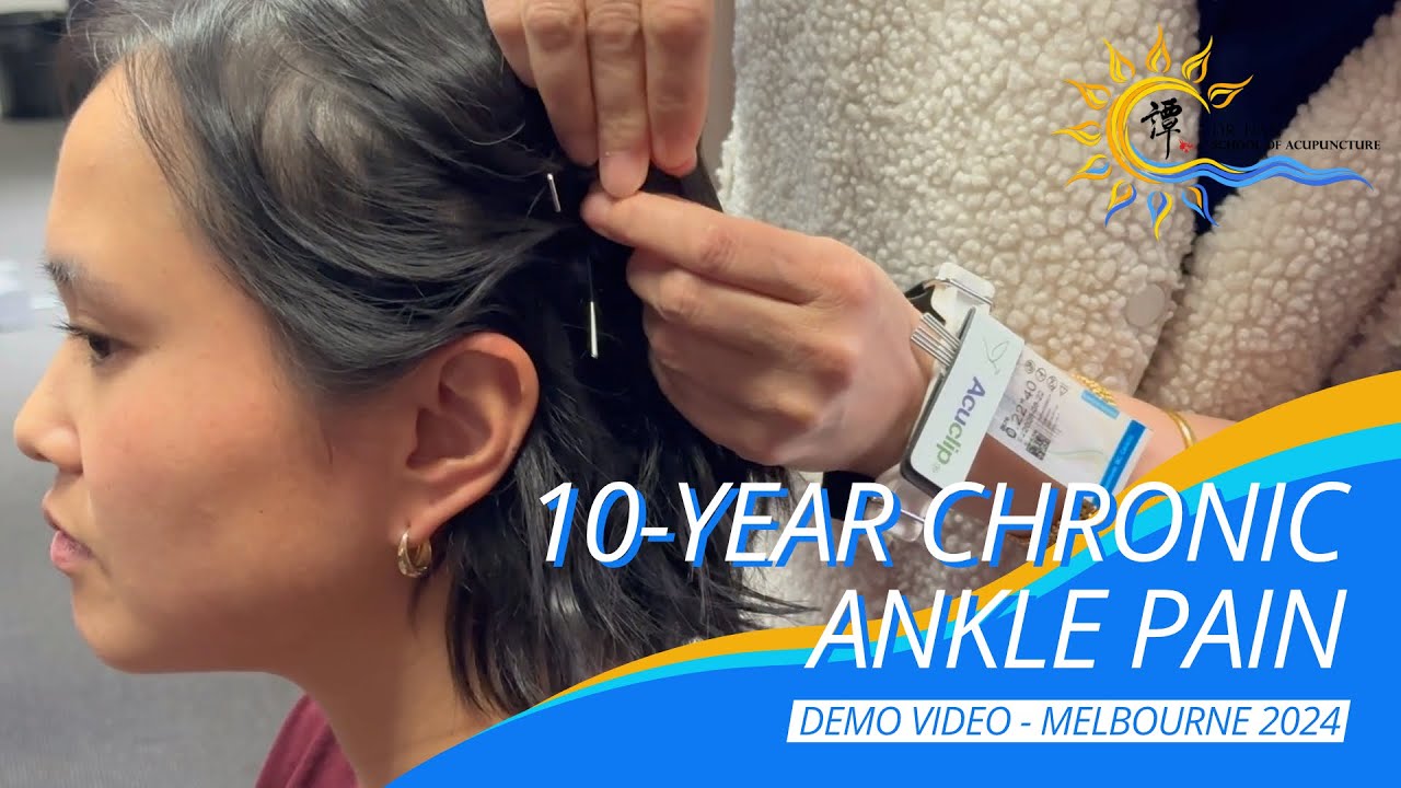 10 Year Chronic Ankle Pain #譚針 #韓玉齡 #eileenhan #正宗譚針 #DrTanBalanceMethodAcupuncture #footpain