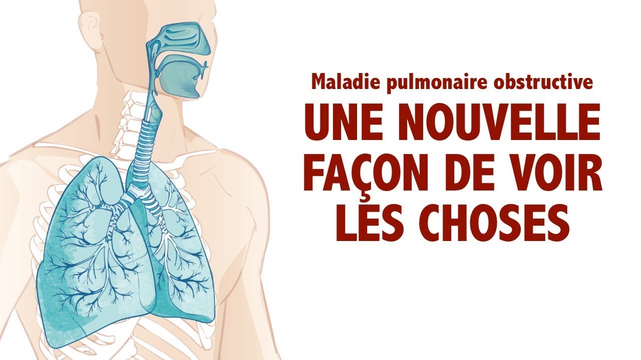 Maladie pulmonaire obstructive : une nouvelle façon voir les choses (MPOC et BPCO)