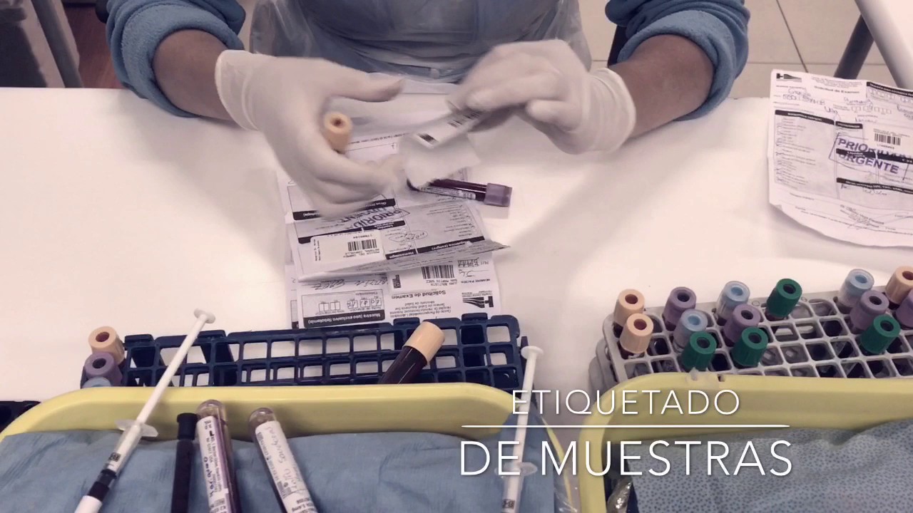 Pre analítica Laboratorio Clínico