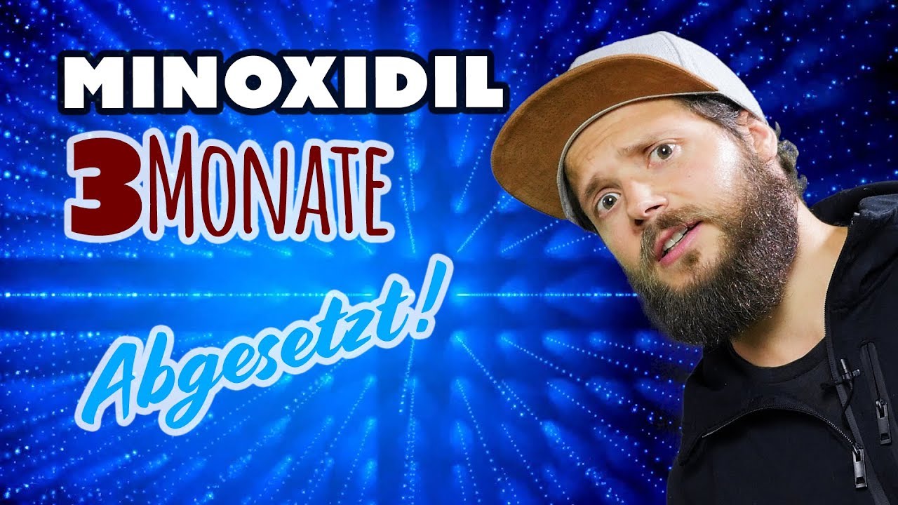 MINOXIDIL 3 Monate abgesetzt | Gipsfu&szlig; Update | Das Minoxidil Experiment
