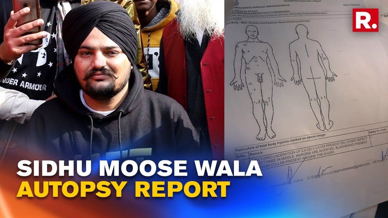 Sidhu Moosewala's Autopsy Report Lists 19 Separate Injuries From Even More Bullets, Most On Right