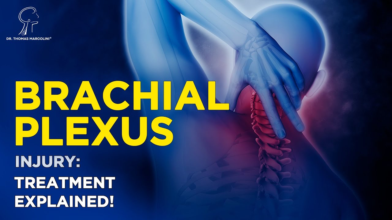 How to Regain Arm Strength? Brachial Plexus Injury Treatment – What You Need to Know! ⚠️