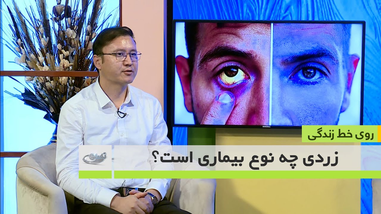 زردی چه نوع بیماری است؟ _روی خط زندگی – 2.06.1402