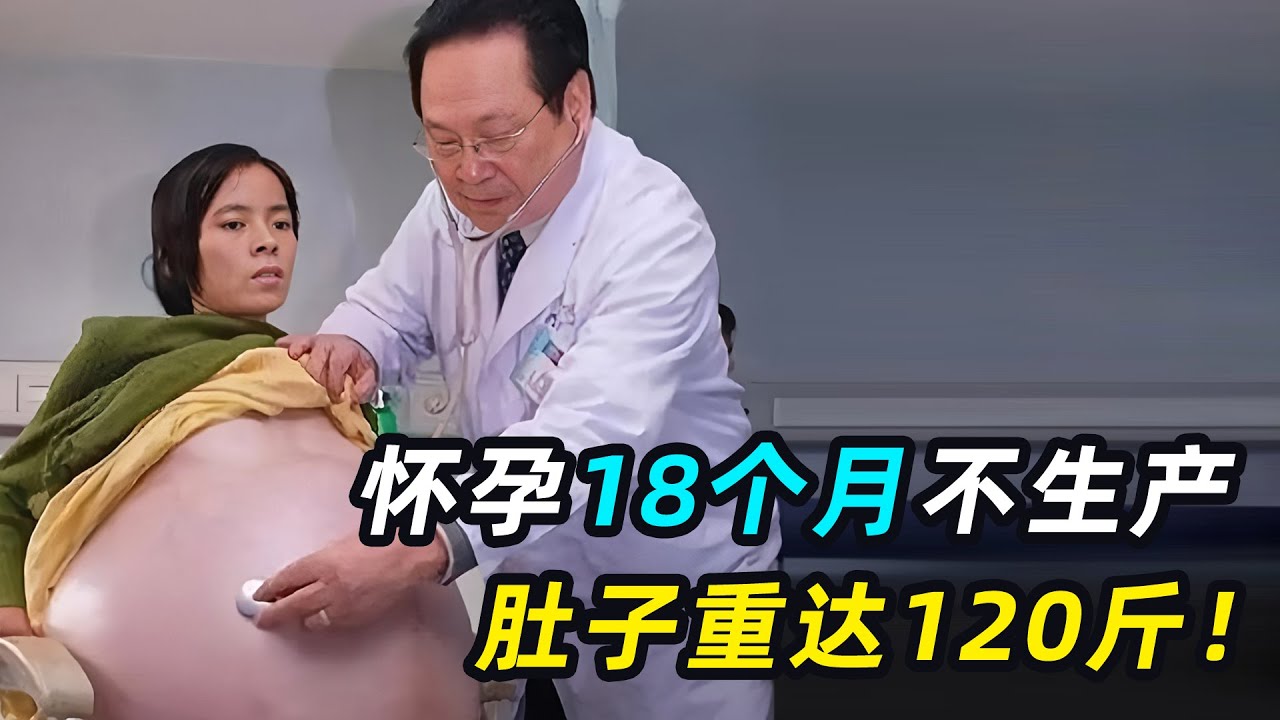 女人怀胎18个月，肚子足足120斤，医生：肚子里没有孩子！
