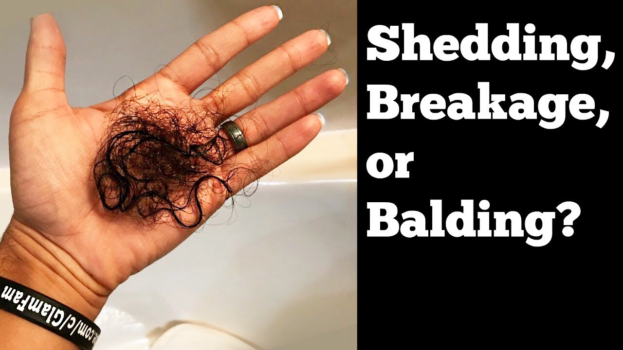 Breaking, Shedding, or Hair Loss? How to tell which one you have! | Understanding Hairloss