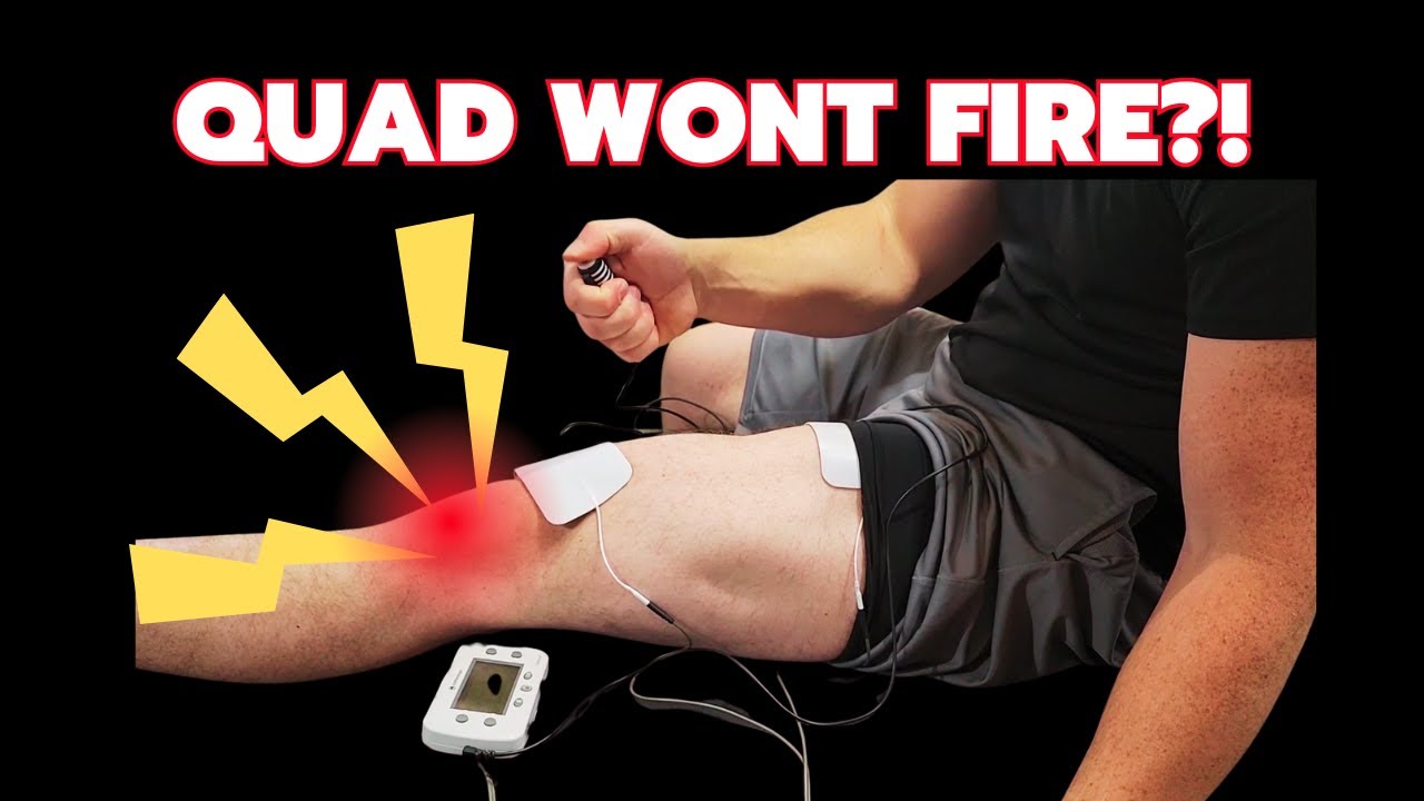 How to Use NMES (Electric Stim) After ACL Surgery (Step-By-Step Tutorial for Faster Quad Recovery)