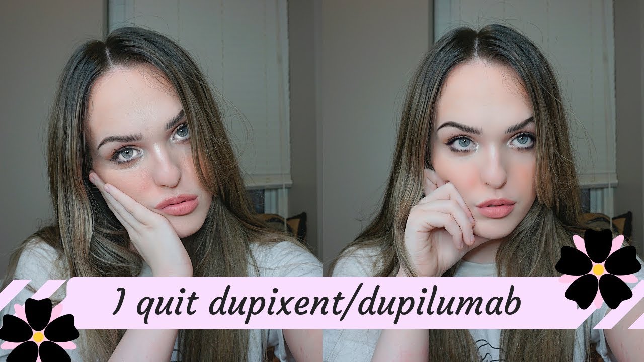 i stopped dupixent for 3 months and this is what happened... (eczema update)