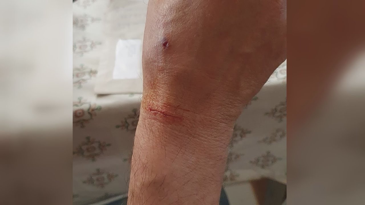 KanizsaTV Híradó - Palini kutyatámadás