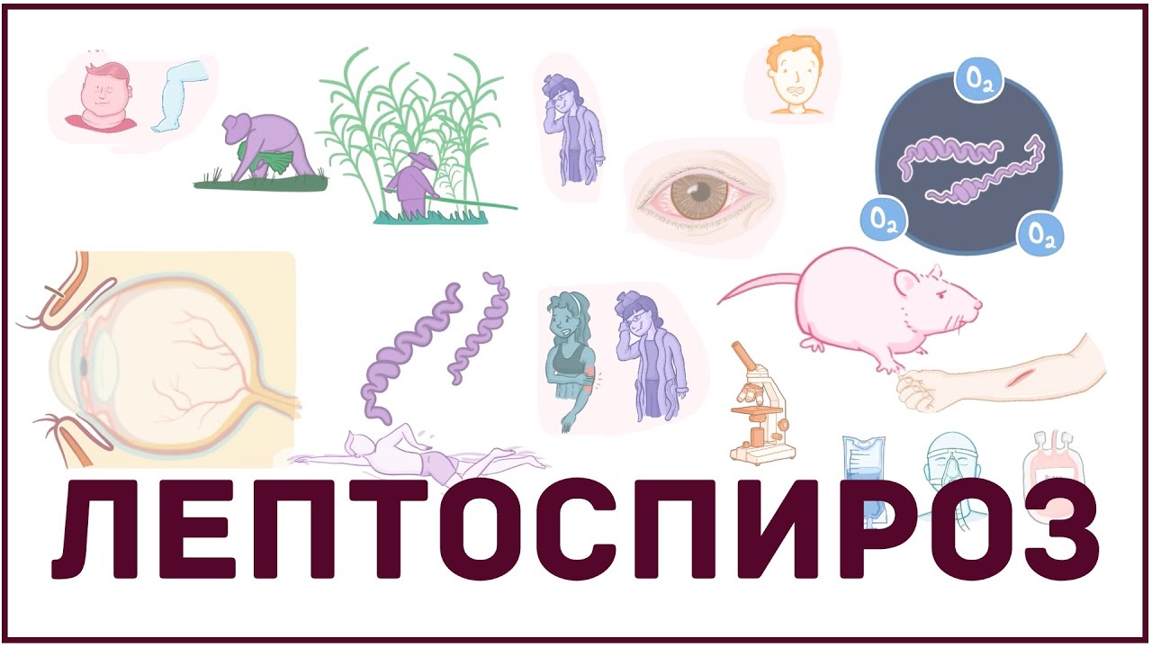 Лептоспироз - причины, симптомы, диагностика, лечение, патология