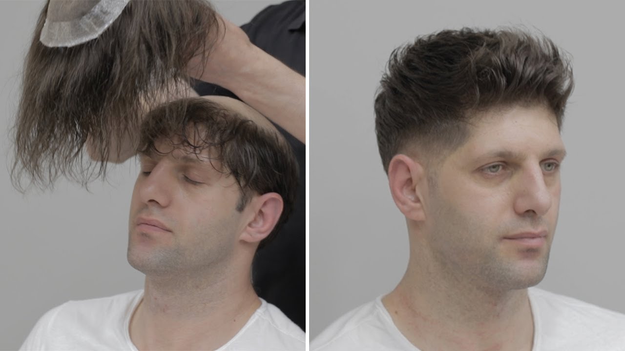 PROTEZ SAÇ UYGULAMASI - Hair Replacement