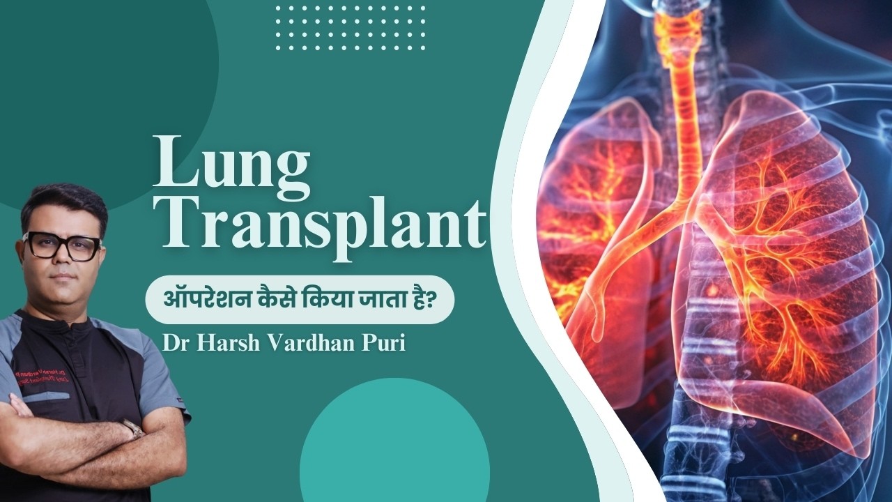 Lung Transplant ऑपरेशन कैसे किया जाता है? Dr Harsh Vardhan Puri