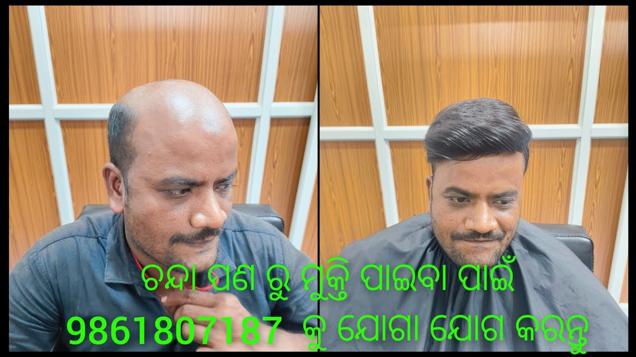 Hair patch ଲଗାନ୍ତୁ ଚନ୍ଦା ପଣ ରୁ ମୁକ୍ତି ପାଆନ୍ତୁ  || No treatment || No medicine. || 🤙9861807187
