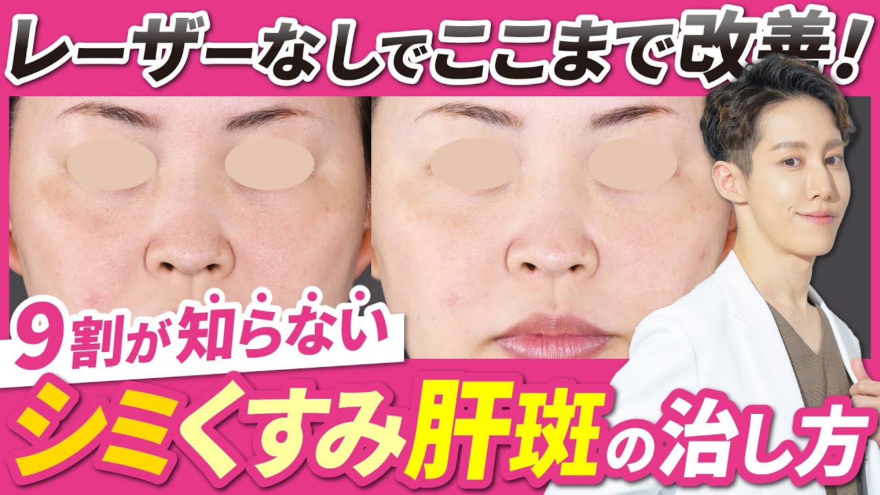 美容皮膚科医が教えるレーザーなしでシミ、くすみ、肝斑を改善する方法