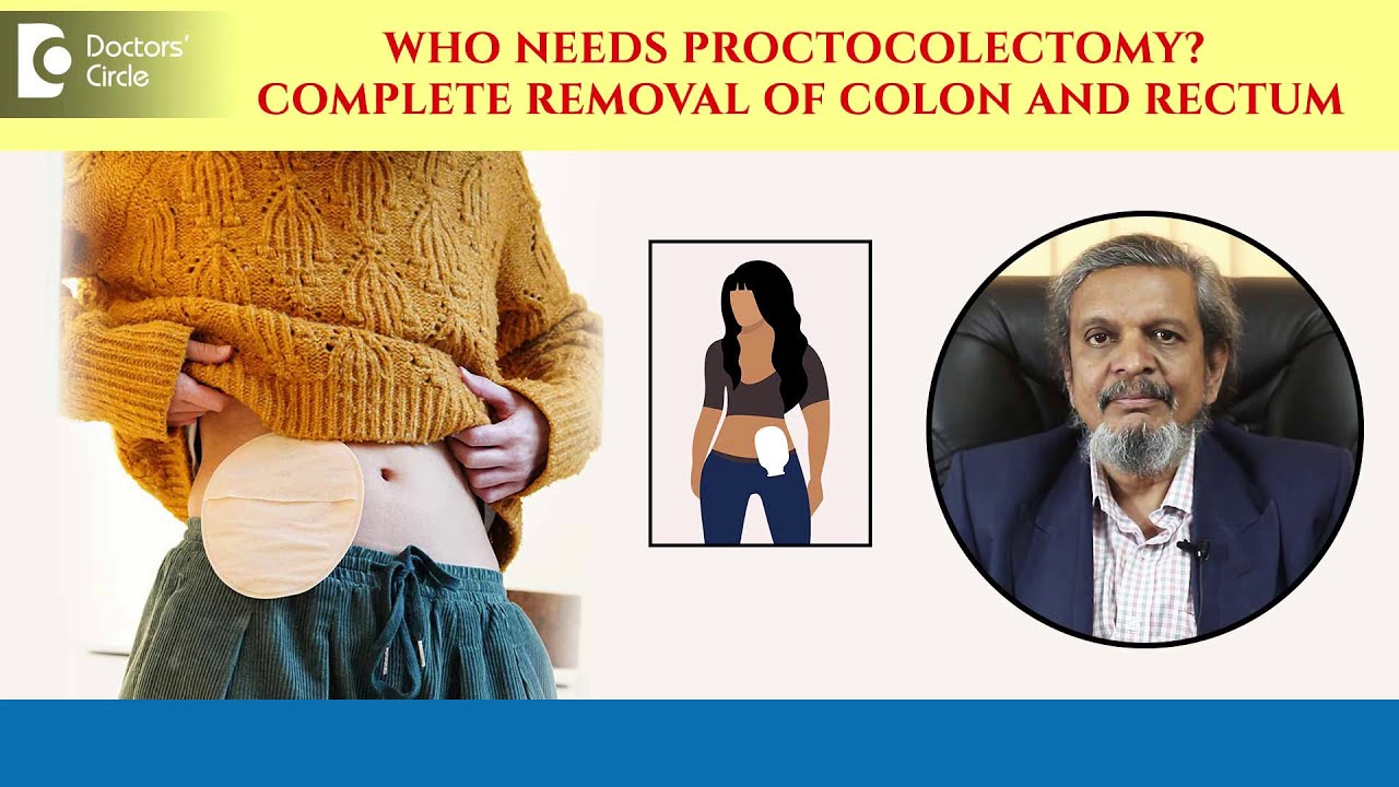 Colon and Rectum Removal|Should you wear a bag after colon surgery?-Dr.Rajasekhar MR|Doctors' Circle