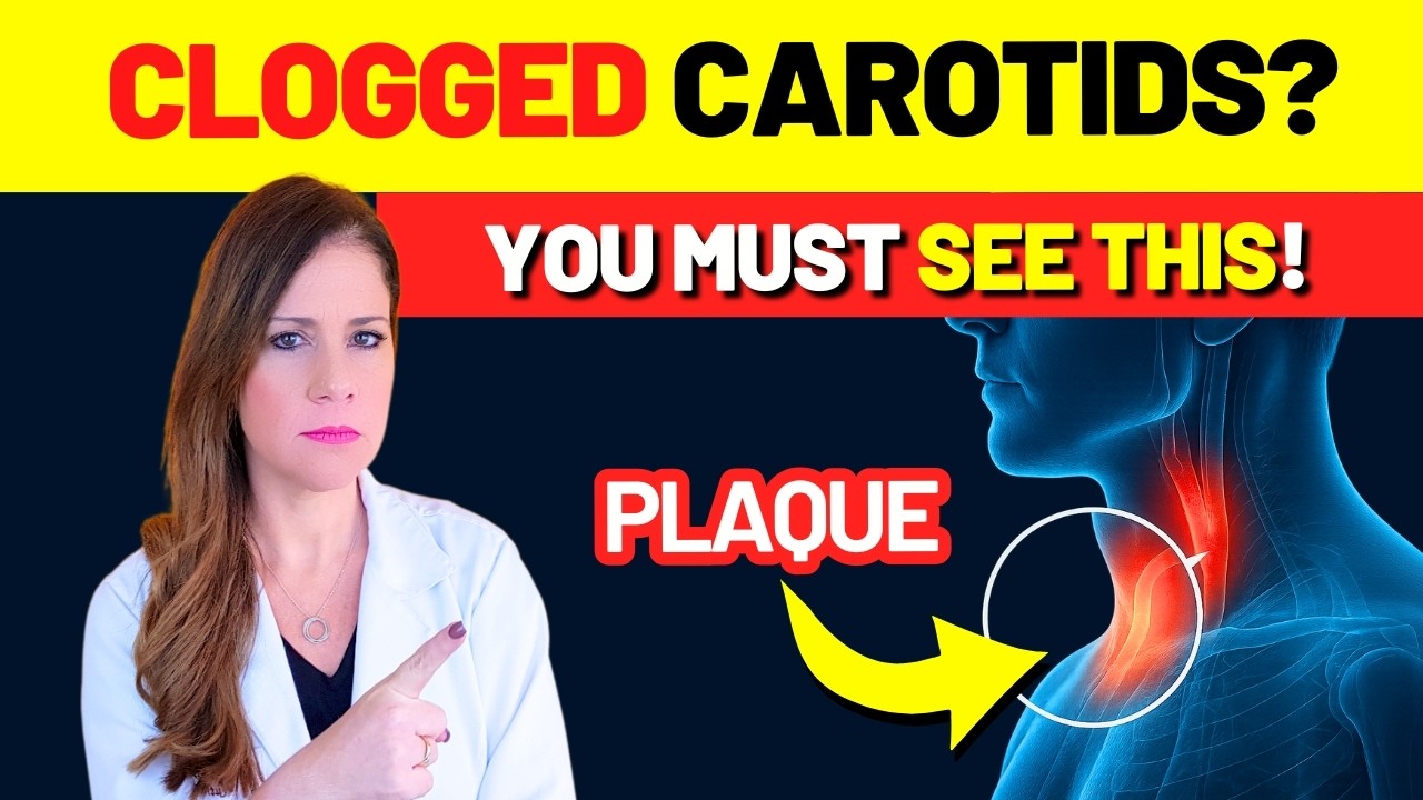 CAROTID PLAQUE? 7 URGENT STEPS to SAVE YOUR ARTERIES