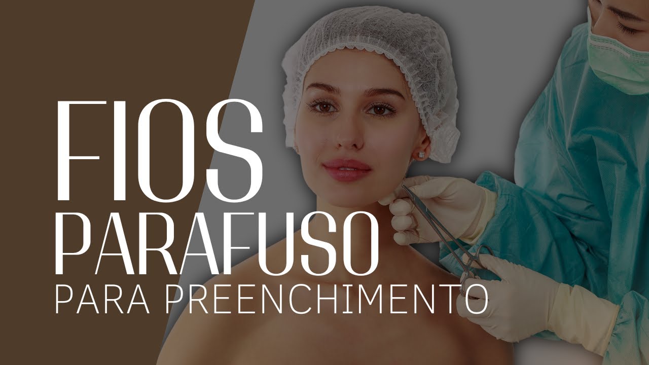 Fios Parafuso para preenchimento