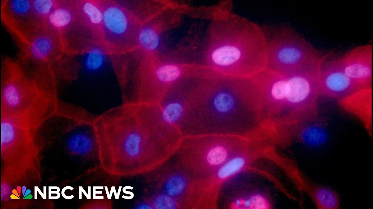 Cancer is on the rise in younger adults