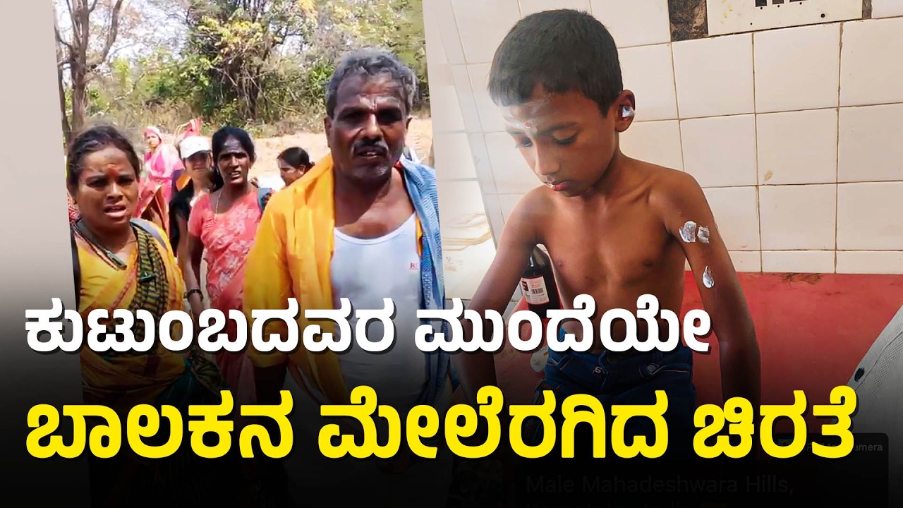 ಮಲೆಮಹದೇಶ್ವರ ಪಾದಯಾತ್ರೆ ವೇಳೆ ಬಾಲಕನ ಮೇಲೆ ಚಿರತೆ ಅಟ್ಯಾಕ್! | Leopard Attack | Suvarna News