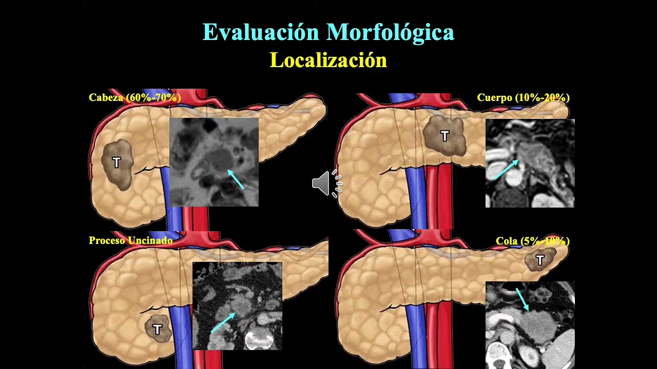Vía Biliar y pancreas Patologico