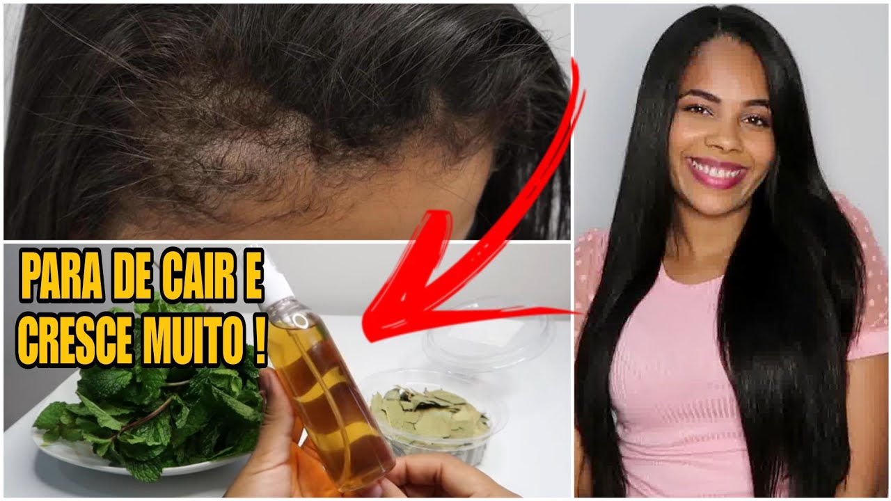COMO FIZ O MEU CABELO PARAR DE CAIR GASTANDO QUASE NADA! não deixe a queda capilar te deixar careca!