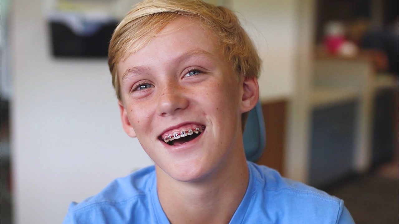 Braces Reveal! | Frost Orthodontics