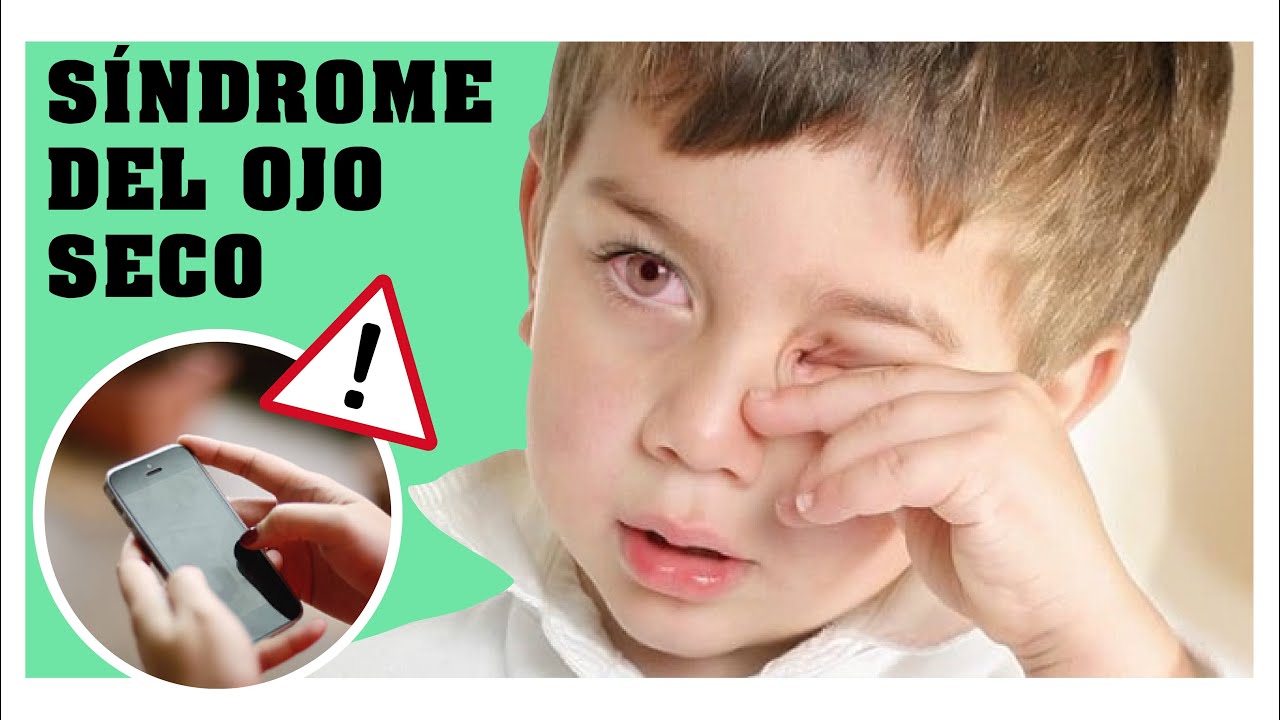 🔸Mi niño tiene ARDOR y PICAZÓN en los ojos? 👀 Síndrome del OJO SECO