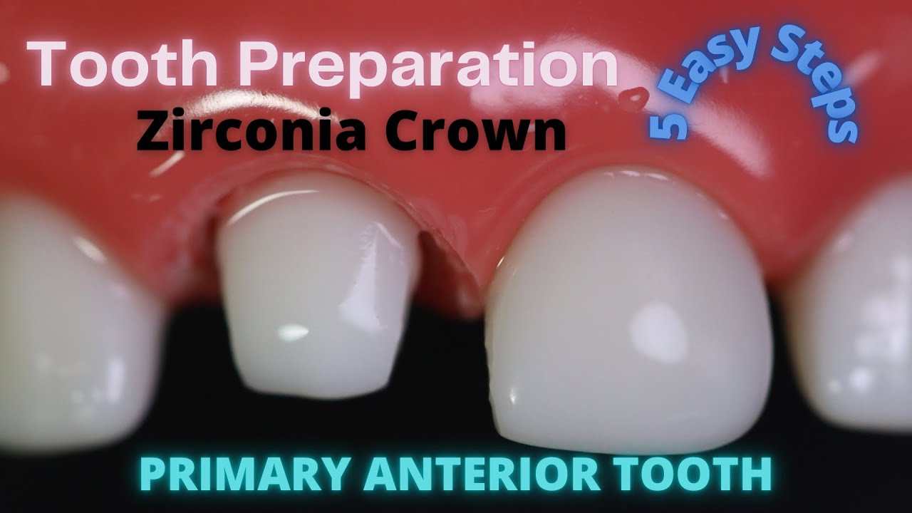 Tooth Preparation for Anterior Zirconia Crown🟡Signature Crowns🔴Preformed Pediatric Zirconia Crown