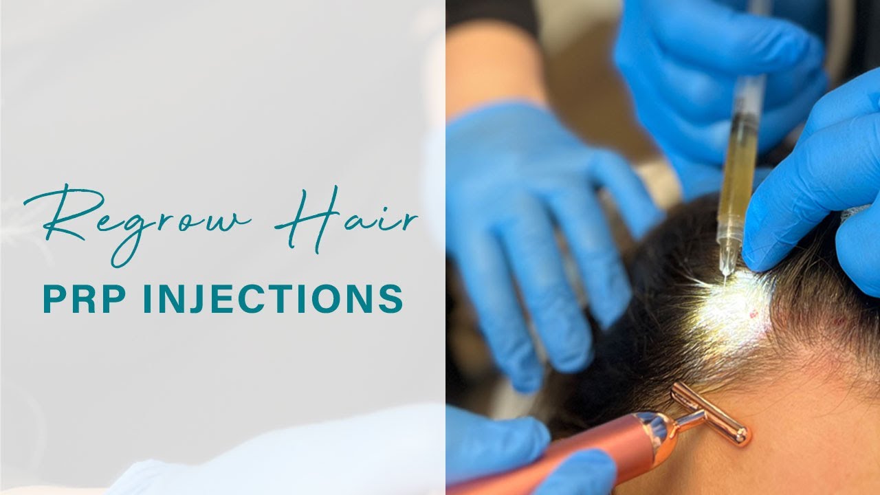 Regrow Hair! | PRP Scalp Injections
