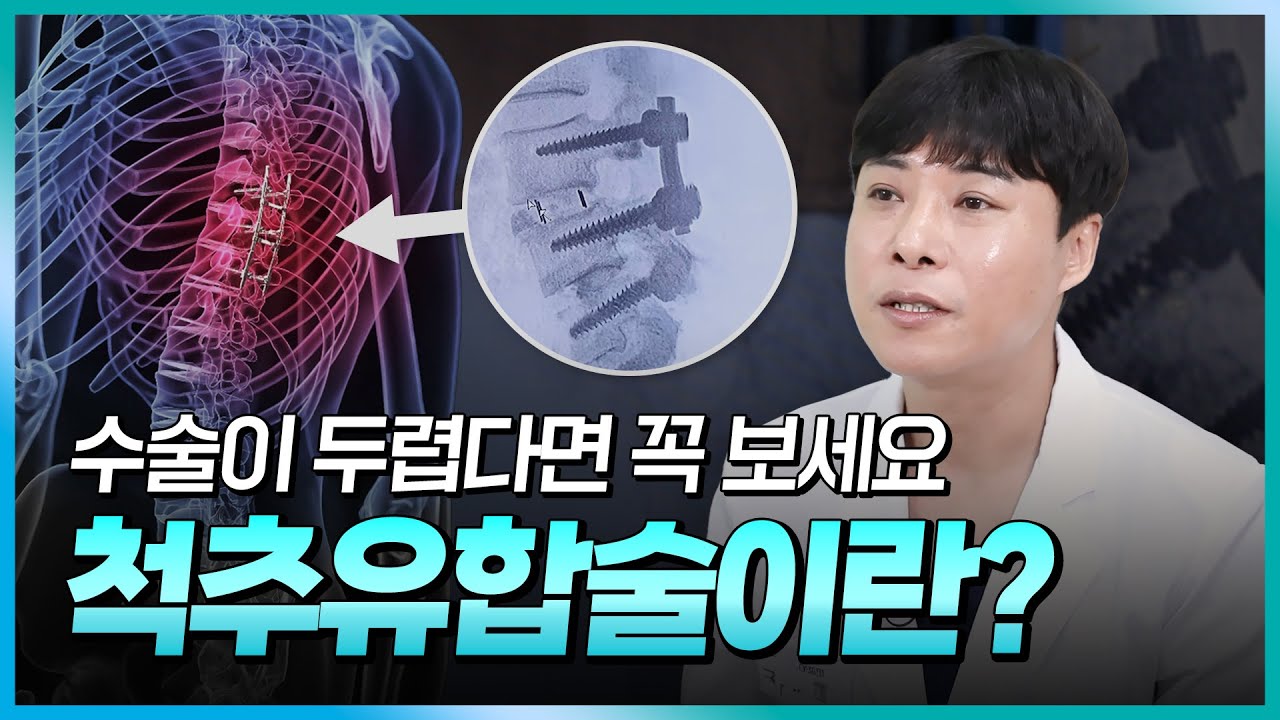 ⚠️흔들리는 척추… 제때 잡아야 합니다! 💥척추유합술 완전 정리