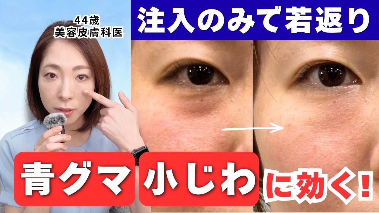 【青グマ・小じわ】に即効く！無駄な治療をしないコツを医師が解説