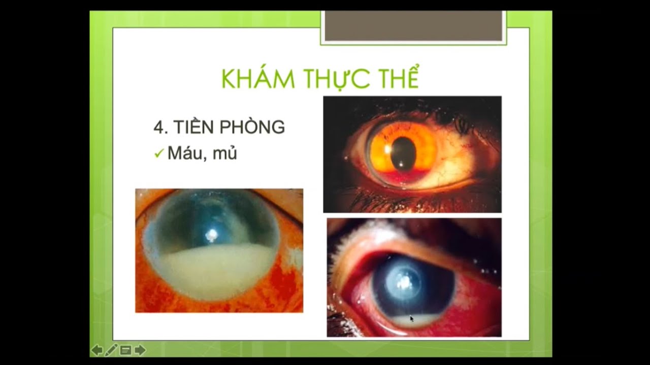 Các Bước Khám Mắt Cơ Bản - ThS.Bùi Thị Quỳnh Anh
