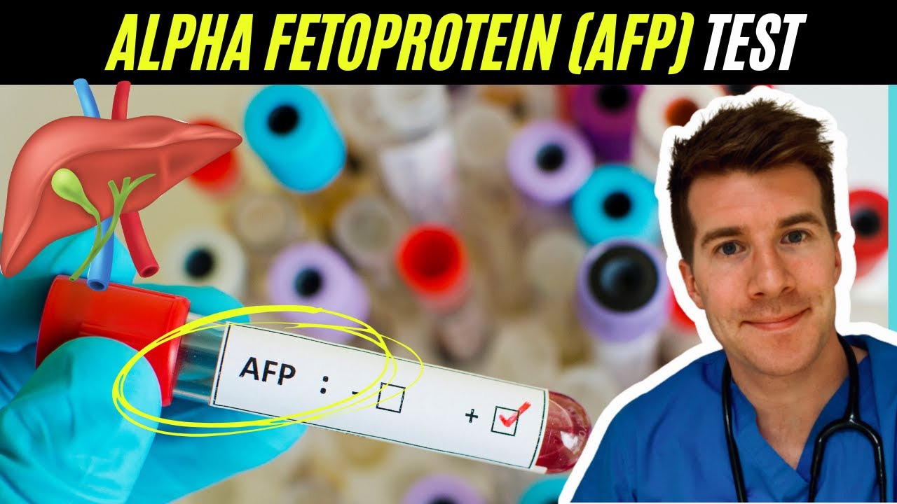 Врач объясняет анализ крови на альфа-фетопротеин (АФП) | Рак печени и яичек