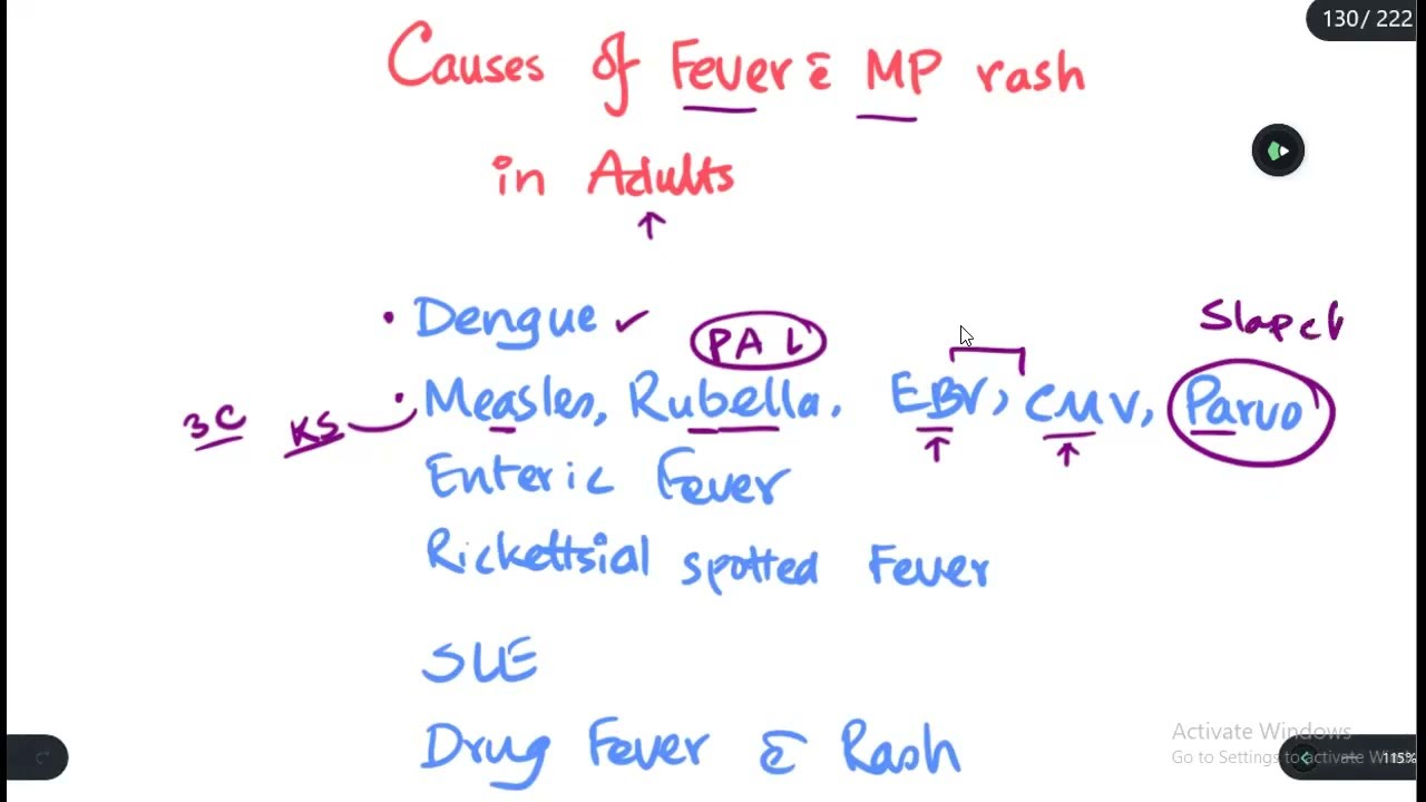 Differential Diagnosis in a patient with fever and Maculopapular rash