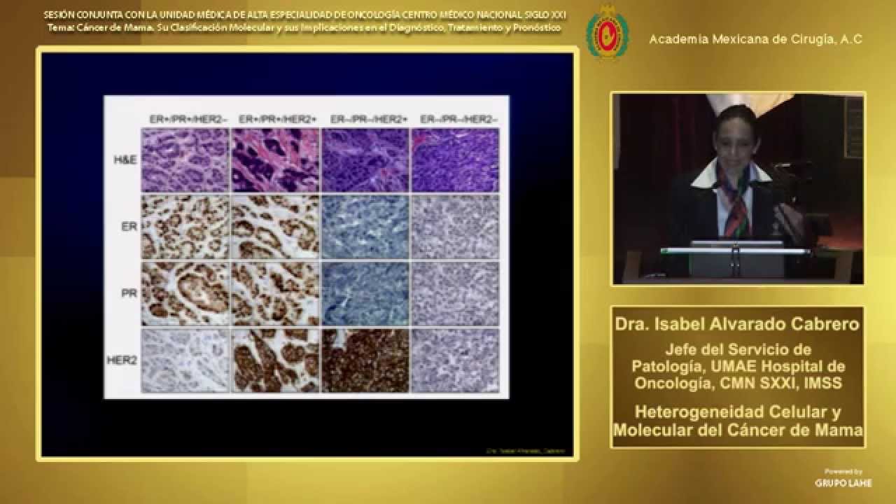 Clasificación Molecular del Cáncer de Mama y Teranóstica, Dra. Isabel Alvarado Cabrero - 26/08/2014