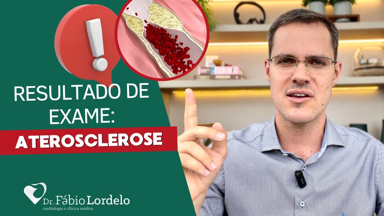 Resultado de Exame: Aterosclerose - Alerta com a sua Saúde!
