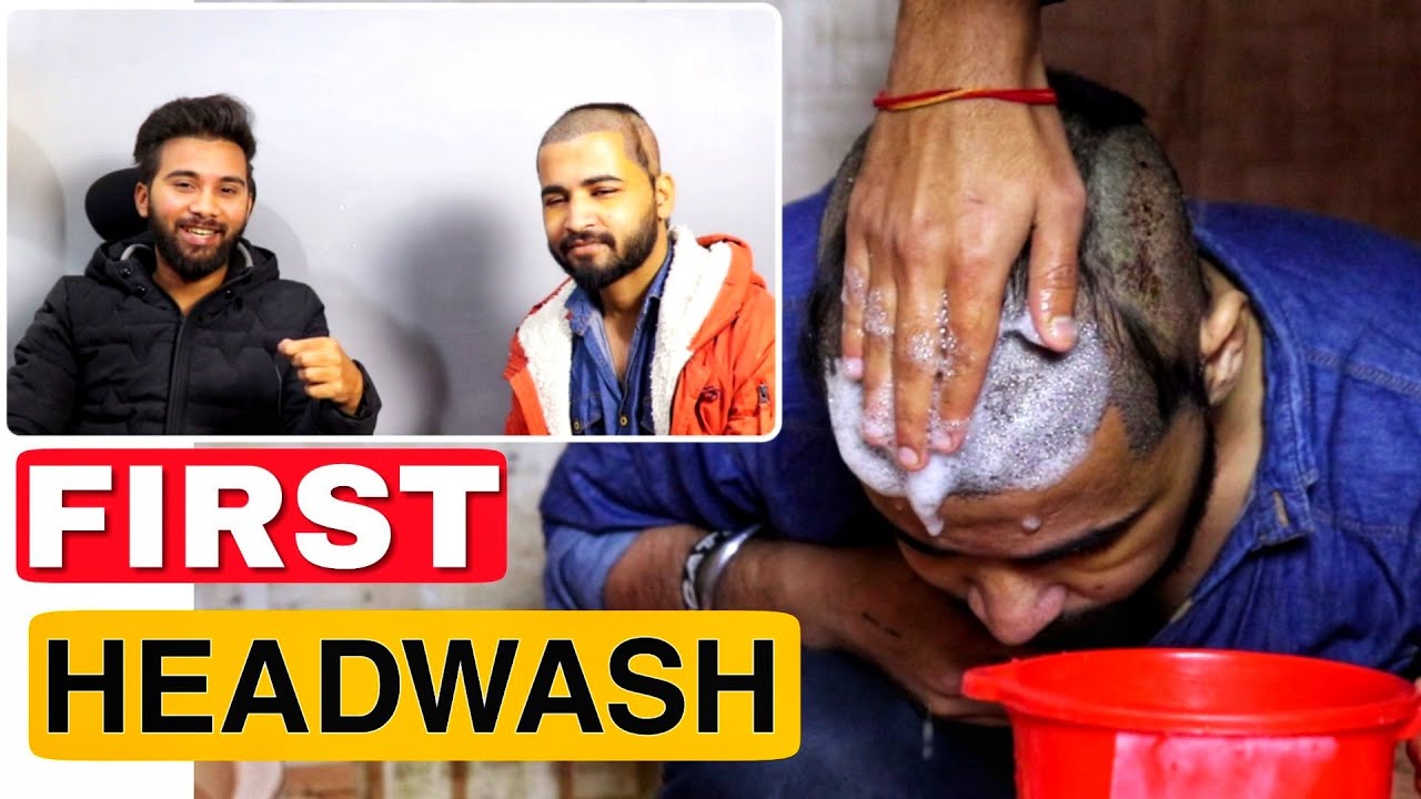 First Head Wash After Hair Transplant (Full Guide) || Follow This To Get Best Hair Transplant Result