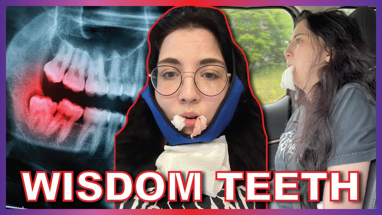 Jessii's Wisdom Teeth Aftermath