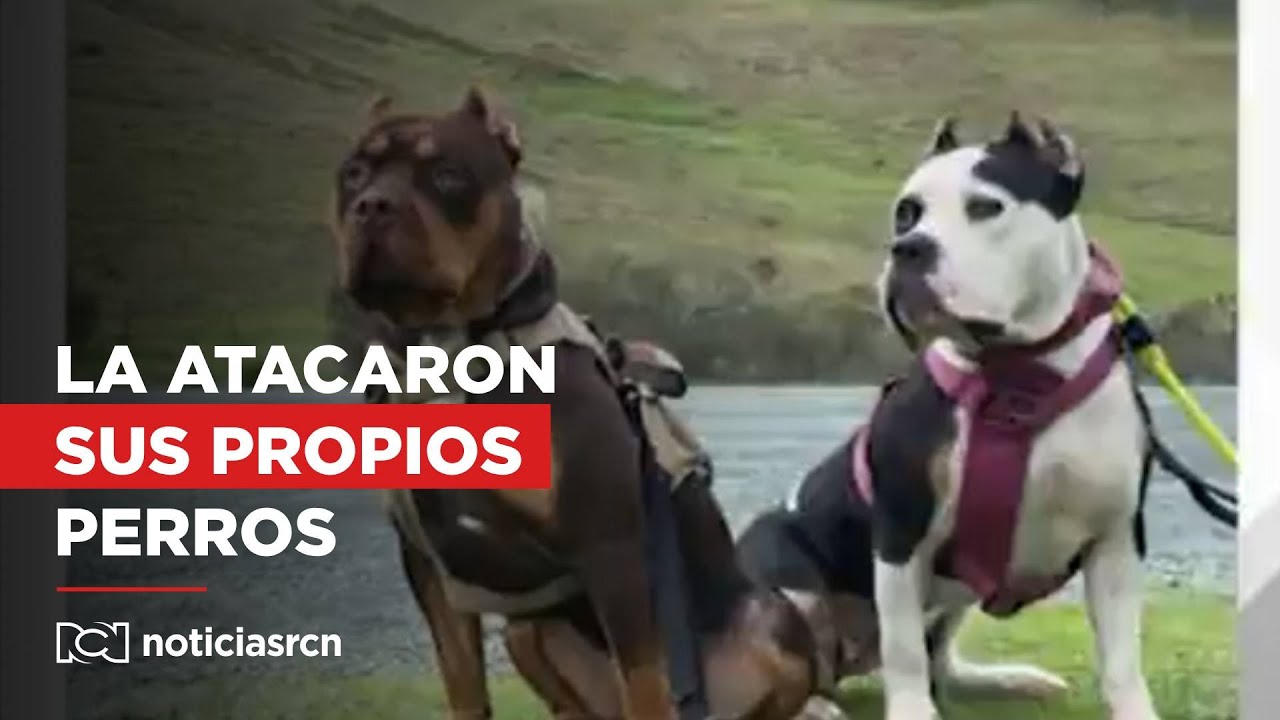 Trágico: joven colombiana fue atacada gravemente por sus perros en Estados Unidos